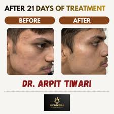 Skin Treatment Result 1