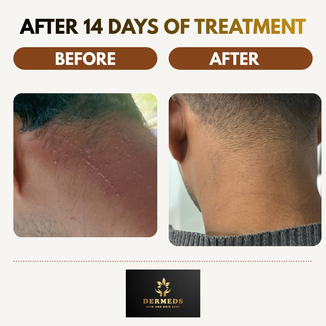 Skin Treatment Result 2