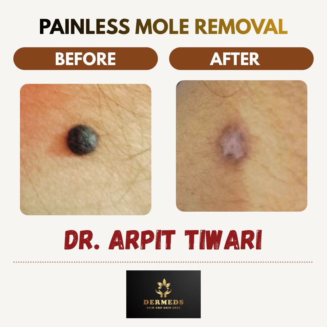 Skin Treatment Result 2