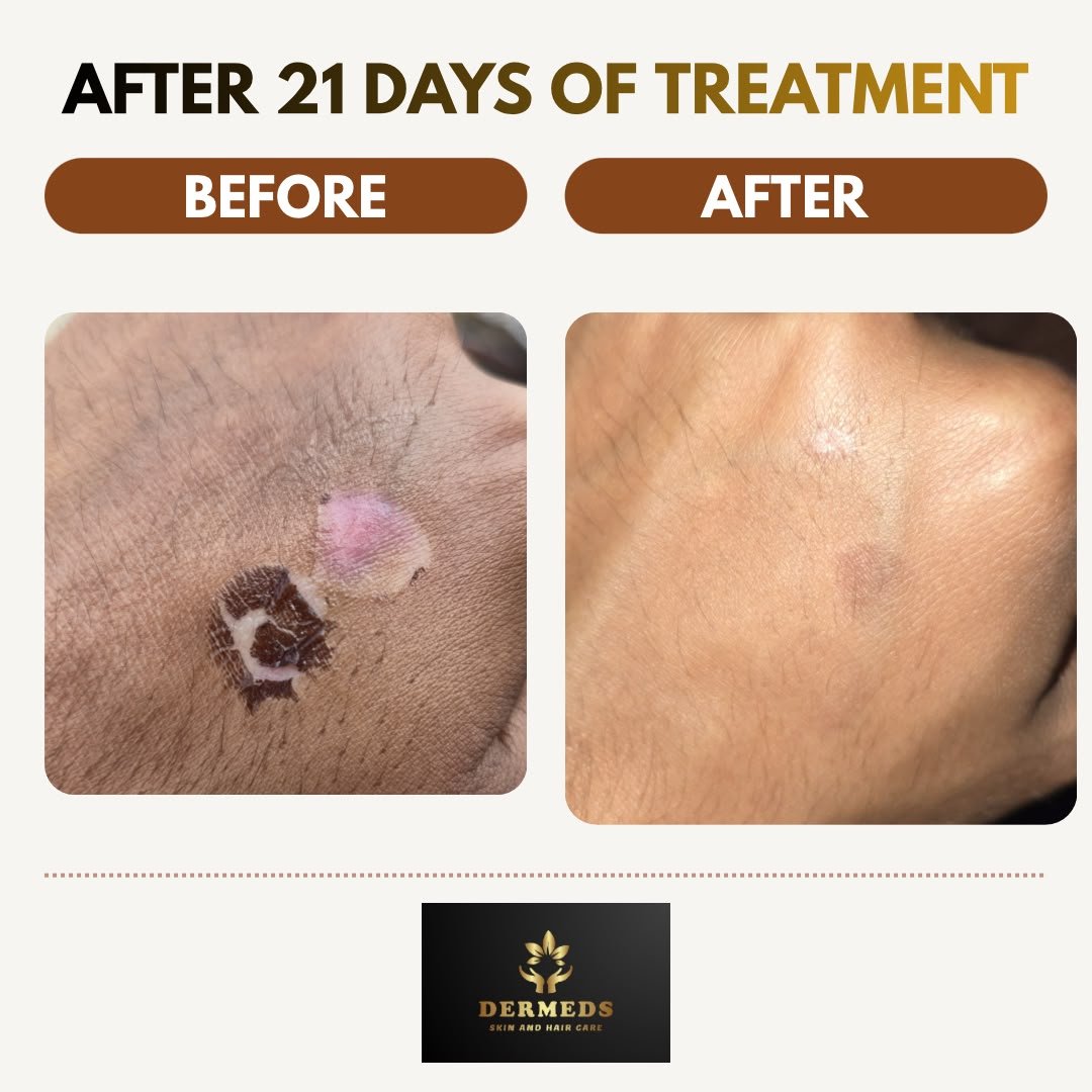 Skin Treatment Result 2
