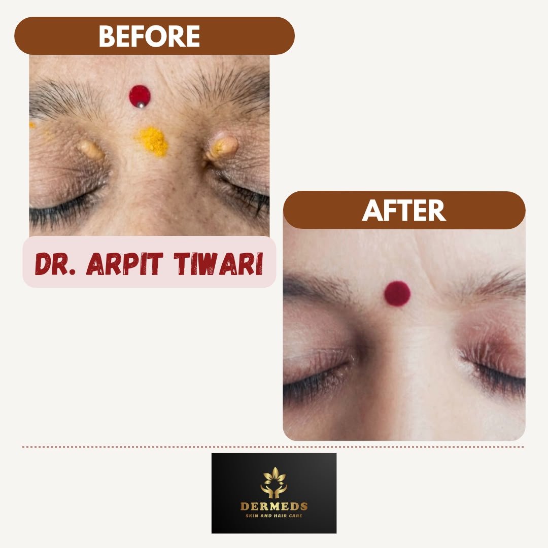 Skin Treatment Result 2