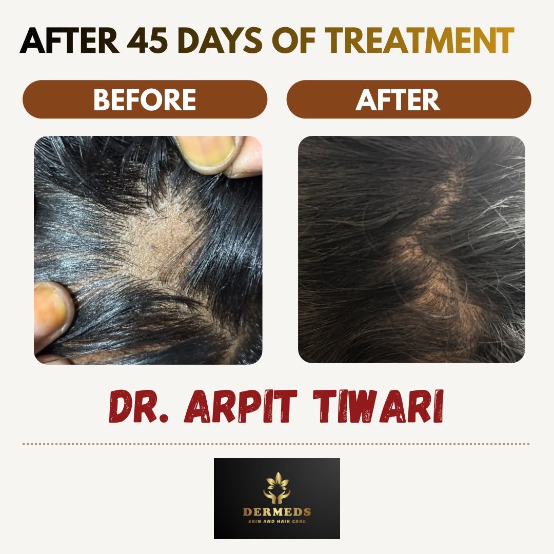 Skin Treatment Result 2